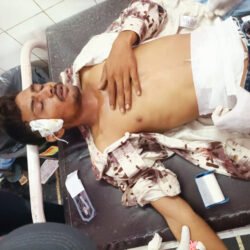 भीण्डर में चाकुबाजी में युवक गंभीर घायल, हमलावर के पिता का सिर फोड़ा